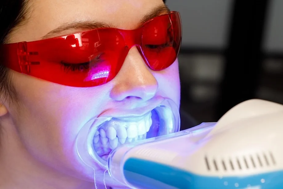 Zoom Teeth Whitening in Dubai