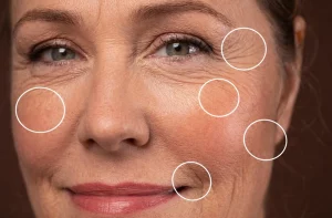 How To Get Rid of Fine Lines