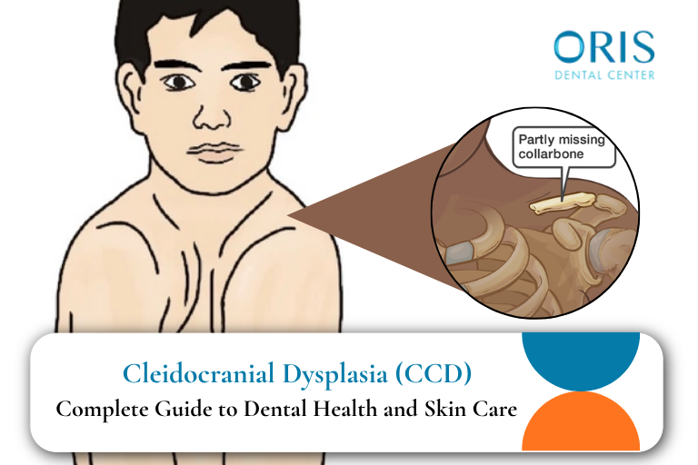 Cleidocranial Dysplasia (CCD)