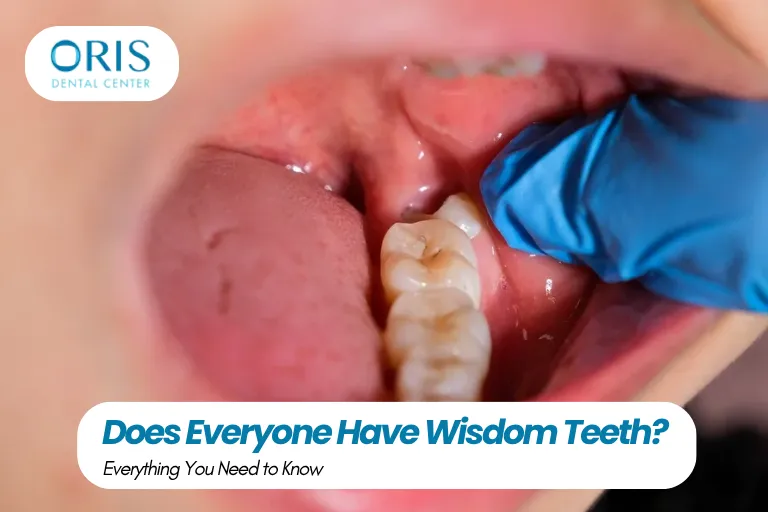 Does Everyone Have Wisdom Teeth
