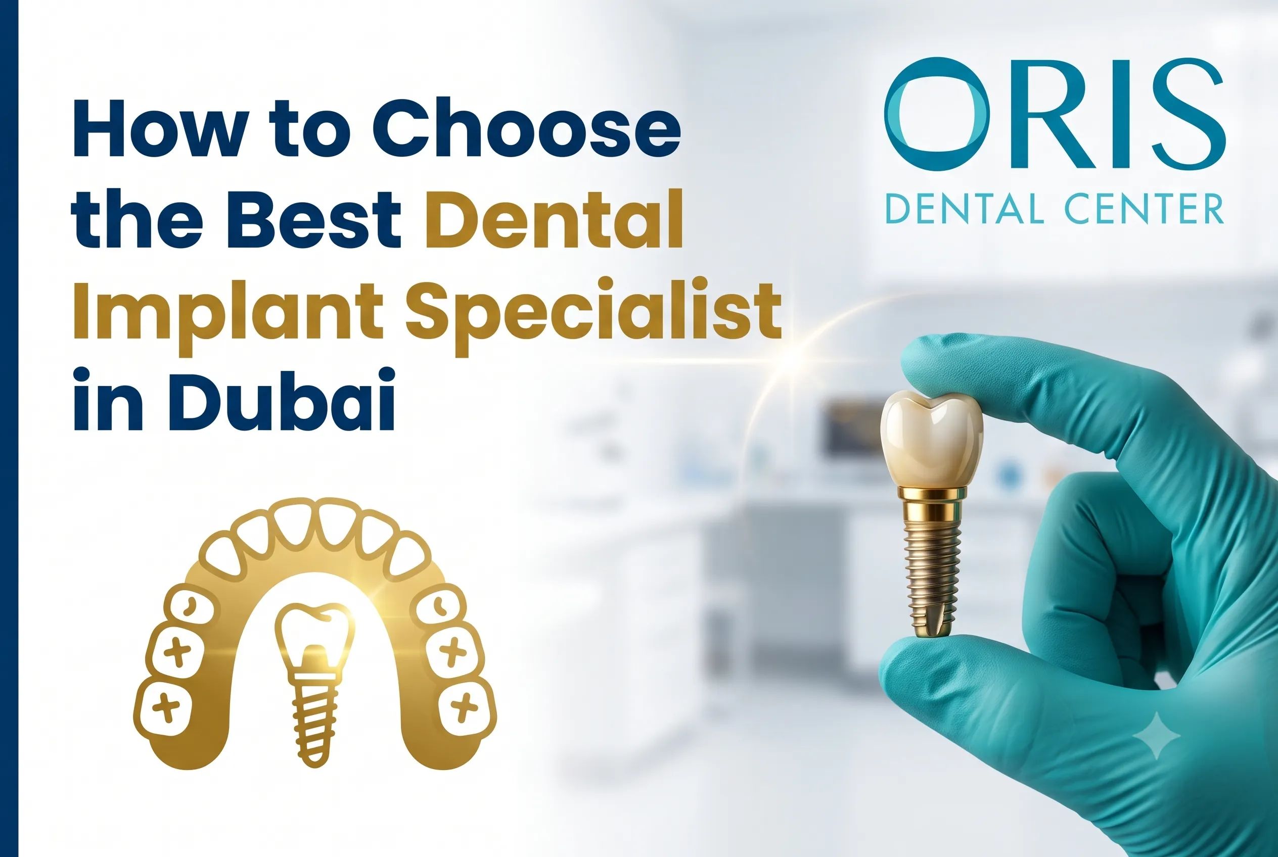 how to find best dental implant specialist in dubai